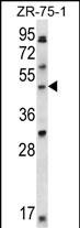 LDB1 Antibody (C-term) (Cat. #AP14866b) western blot analysis in ZR-75-1 cell line lysates (35ug/lane).This demonstrates the LDB1 antibody detected the LDB1 protein (arrow).