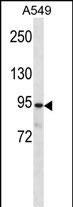 WB - PKP3 Antibody (C-term) AP14907b