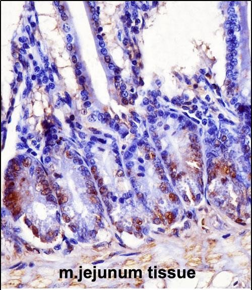 IHC-P - Mouse Hoxb7 Antibody (Center) AP14925c