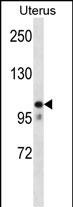 MOV10 Antibody (N-term) (Cat. #AP14933a) western blot analysis in human normal Uterus tissue lysates (35ug/lane).This demonstrates the MOV10 antibody detected the MOV10 protein (arrow).