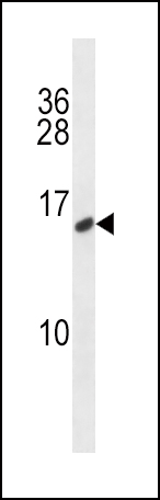 CALCA/CT Antibody (C-term) (Cat. #AP14934b) western blot analysis in MDA-MB231 cell line lysates (35ug/lane).This demonstrates the CALCA/CT antibody detected the CALCA/CT protein (arrow).
