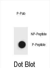 DB - Phospho-Belcin 1 Antibody AP3765a