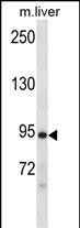 WB - Mouse Dclk1 Antibody (N-term) AP14964a