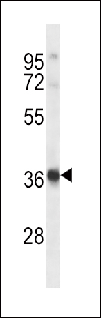 WB - HRH2 Antibody (Center) AP14970c