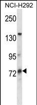 WB - MUM1L1 Antibody (Center) AP14990C