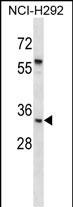 WB - UPK1B Antibody (C-term) AP14995B