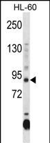 DNMT3A Antibody (CenterR478) (Cat. #AP14999c) western blot analysis in HL-60 cell line lysates (35ug/lane).This demonstrates the DNMT3A antibody detected the DNMT3A protein (arrow).