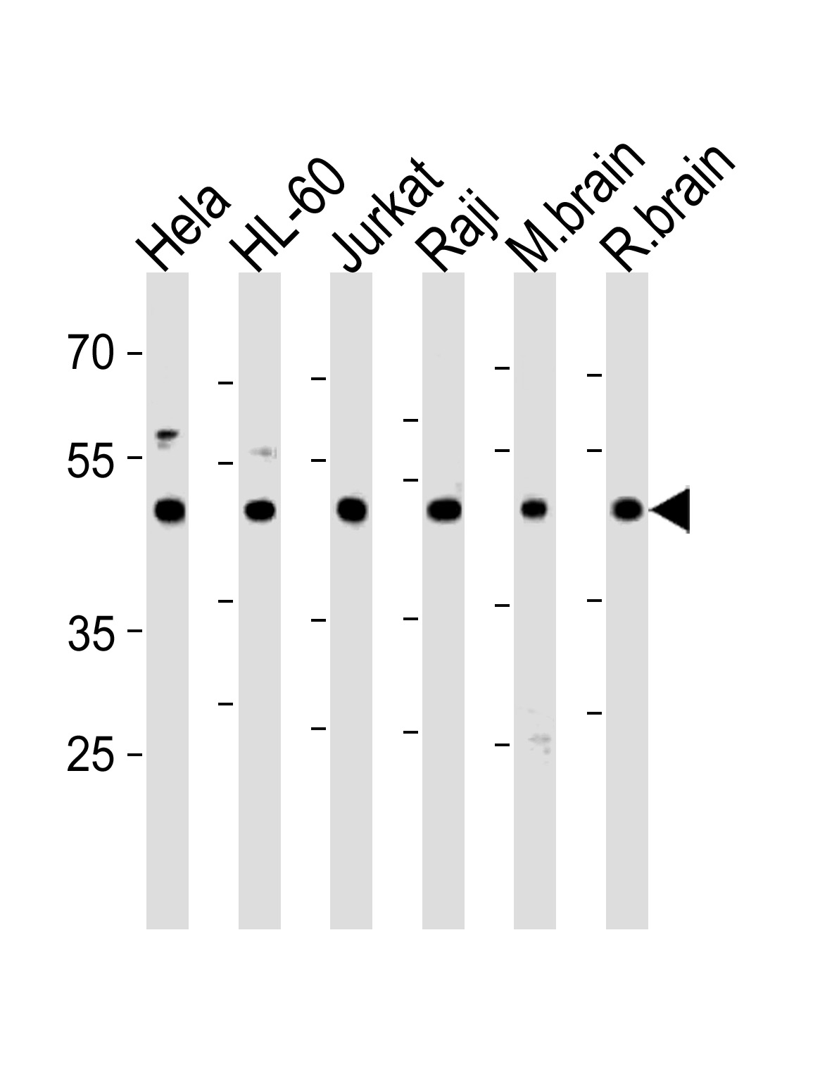 CTBP1 Antibody (C-term) (Cat. #AP16004b) western blot analysis in Hela,HL-60,Jurkat,Raji cell line and mouse brain,rat brain tissue lysates (35ug/lane).This demonstrates the CTBP1 antibody detected the CTBP1 protein (arrow).