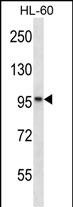 WB - KANK2 Antibody (Center) AP16024c