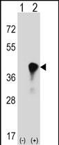 WB - C4BPB Antibody (Center) AP16055c