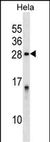 WB - PPP1R2 Antibody (Center) AP16058B