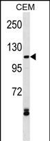 WB - EVI1 Antibody (N-term) AP16088a