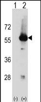 WB - Mouse Stk3 Antibody (C-term) AP16096b