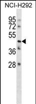 WB - TMEM102 Antibody (N-term) AP16098a
