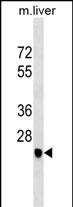WB - SGCD Antibody (C-term) AP16115b