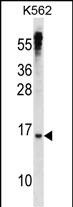 WB - MXD3 Antibody (N-term) AP16120a