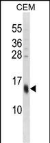 WB - SPRR3 Antibody (C-term) AP16124b