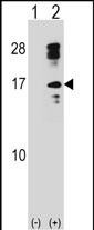 Western blot analysis of CLC (arrow) using rabbit polyclonal CLC Antibody (C-term) (Cat. #AP16125b). 293 cell lysates (2 ug/lane) either nontransfected (Lane 1) or transiently transfected (Lane 2) with the CLC gene.