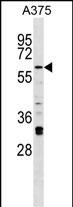 WB - Mouse Irak2 Antibody (C-term) AP16150b