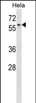 AGFG1 Antibody (N-term) (Cat. #AP16184a) western blot analysis in Hela cell line lysates (35ug/lane).This demonstrates the AGFG1 antibody detected the AGFG1 protein (arrow).