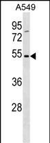 WB - TM6SF1 Antibody (N-term) AP16209a
