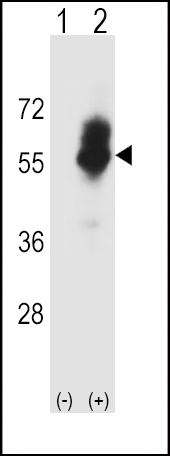 WB - SLC7A1 Antibody (C-term) AP16229b
