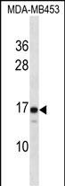 WB - LIM2 Antibody (C-term) AP16239b