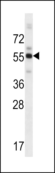 WB - ZBTB8B Antibody (C-term) AP16258b