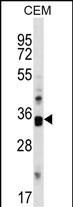 Mouse Cdk10 Antibody (C-term) (Cat. #AP16261b) western blot analysis in CEM cell line lysates (35ug/lane).This demonstrates the Cdk10 antibody detected the Cdk10 protein (arrow).