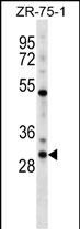 WB - HOXD1 Antibody (N-term) AP16263a