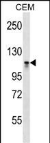 DNMT3A Antibody (C-term V897) (Cat. #AP16264b) western blot analysis in CEM cell line lysates (35ug/lane).This demonstrates the DNMT3A antibody detected the DNMT3A protein (arrow).