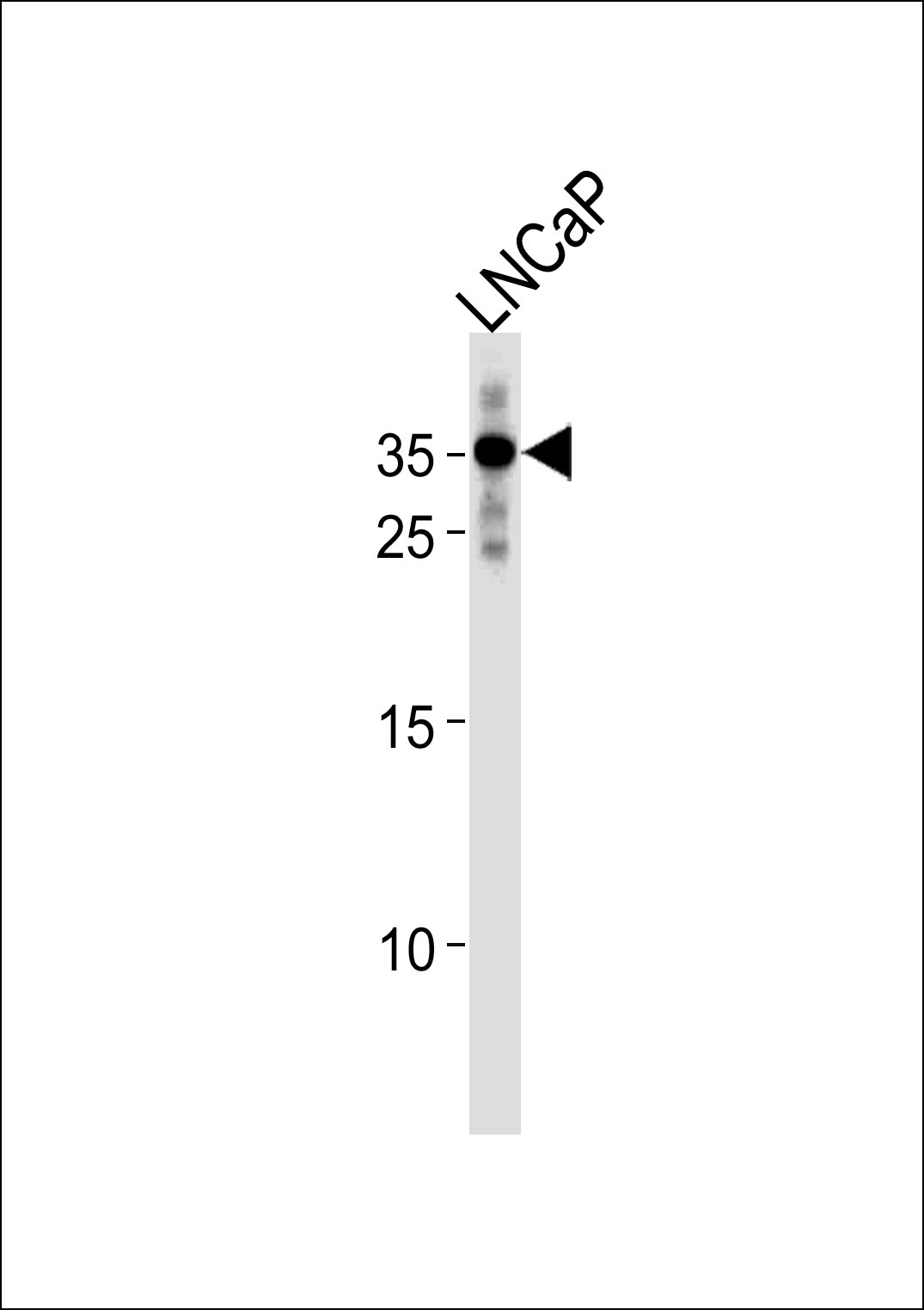 WB - RNF4 Antibody (C-term) AP16278b