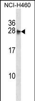 WB - MOCS2 Antibody (N-term) AP16279a