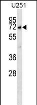 WB - MKKS Antibody (C-term) AP16289b