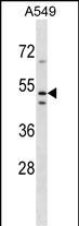 WB - TMEM200A Antibody (N-term) AP16298a