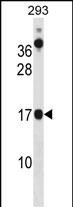WB - CHCHD10 Antibody (N-term) AP16303a