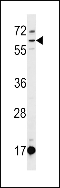 WB - DEPDC1B Antibody (C-term) AP16306b