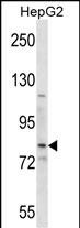 WB - SMO Antibody (Center) AP16325c