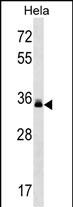 WB - LMAN2 Antibody (C-term) AP16328b
