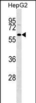 WB - GFRA3 Antibody (Center) AP16331C