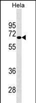 NUAK2 Antibody (Cat. #AM1988b) western blot analysis in Hela cell line lysates (35?g/lane).This demonstrates the NUAK2 antibody detected the NUAK2 protein (arrow).