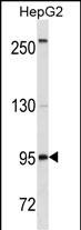 CD19 Antibody (C-term) (Cat. #AM1989a) western blot analysis in HepG2 cell line lysates (35?g/lane).This demonstrates the CD19 antibody detected the CD19 protein (arrow).