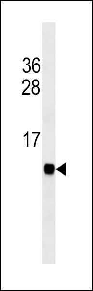 Cardiac FABP  Antibody (Cat. #AM2000a) western blot analysis in mouse heart tissue lysates (35?g/lane).This demonstrates the Cardiac FABP antibody detected the Cardiac FABP protein (arrow).