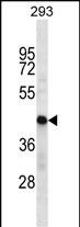 WB - HSDL2 Antibody (Center) AP16340c