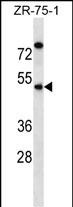 WB - EME2 Antibody (C-term) AP16348b
