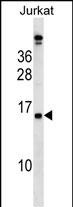 WB - PLAC4 Antibody (N-term) AP16388a