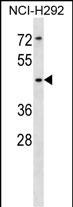 WB - SIGLEC14 Antibody (N-term) AP16393a