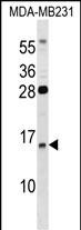 WB - GUCA2B Antibody (C-term) AP16404b
