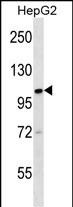 KIF18A Antibody (C-term) (Cat. #AP16406b) western blot analysis in HepG2 cell line lysates (35ug/lane).This demonstrates the KIF18A antibody detected the KIF18A protein (arrow).