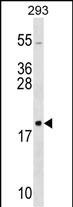 WB - RPL26 Antibody (C-term) AP16410b